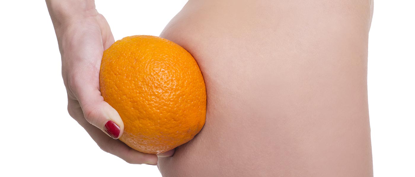 una signora si regge un'arancia vicino al sedere per sensibilizzare sulla cellulite